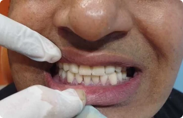 Restorative Dentistry restorative-image