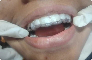 Cosmetic Dentistry Cosmetic-img